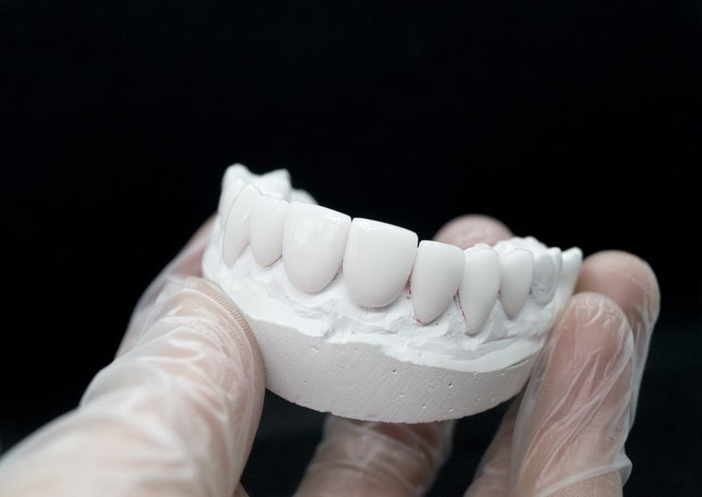 Odontología estética en A Coruña