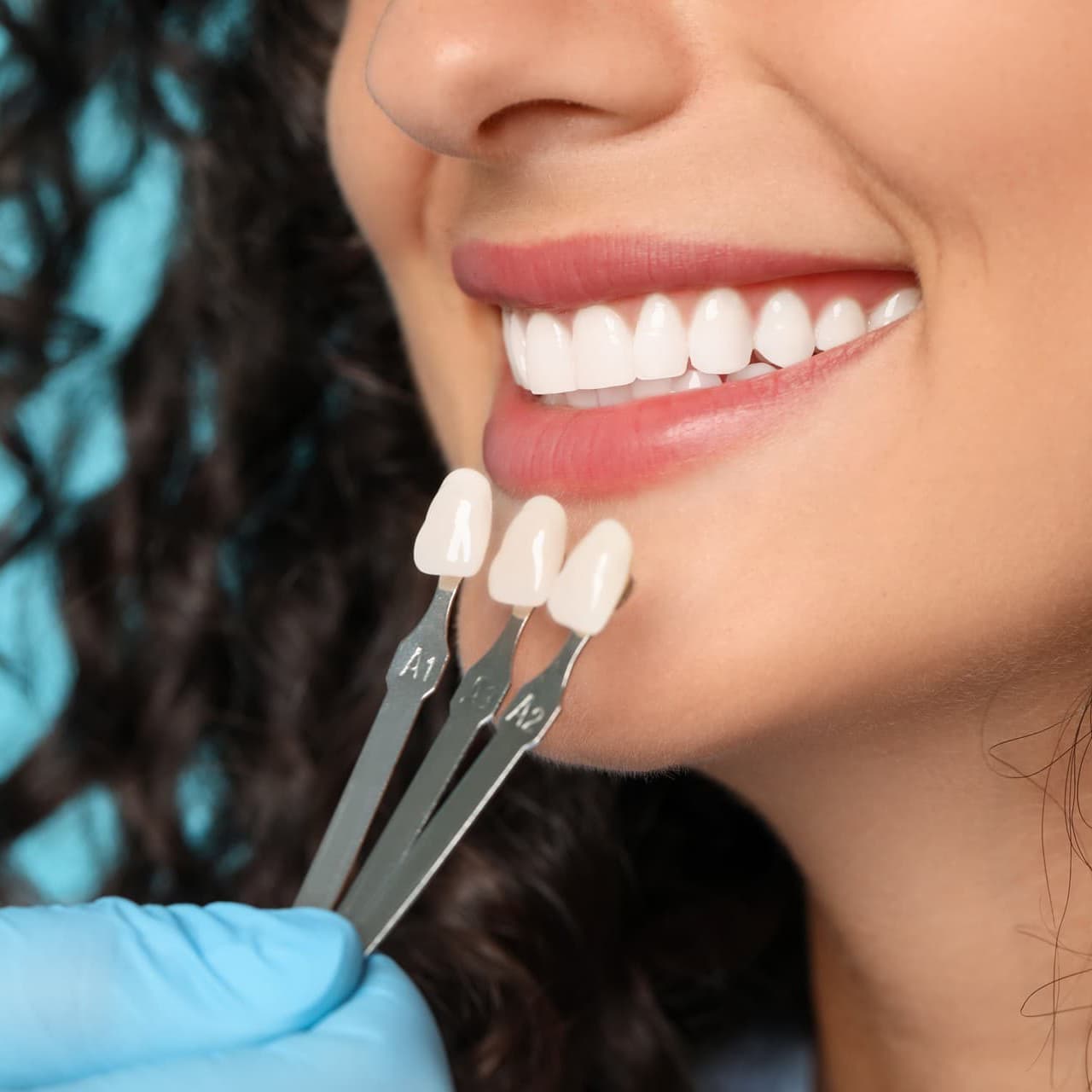 Estética dental en A Coruña